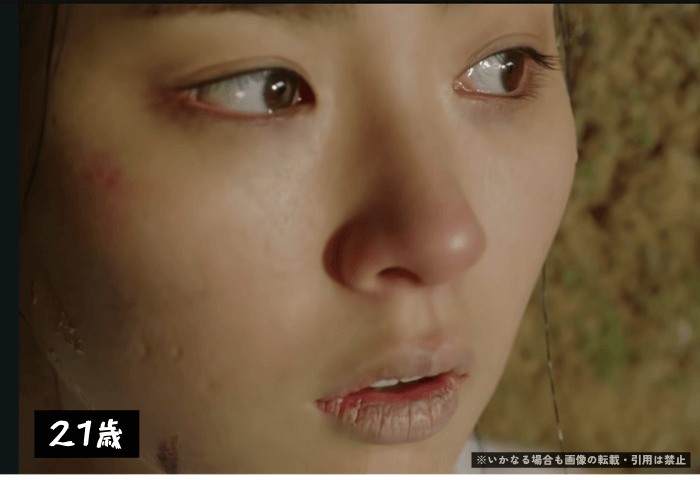 韓国女優シン・セギョンがドラマ「根の深い木」に出演した際の画像。
顔に傷がありやつれている状況のシーン。
右ほほに幼いころに爪でひっかいた傷（穴）が確認できる。